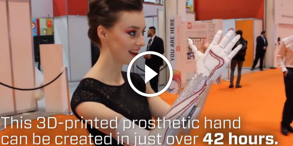 See The First 3D PRINTED PROSTHETIC HAND Open Bionics 5