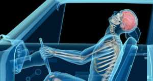 What Is Considered As A Traumatic Brain Injury 2